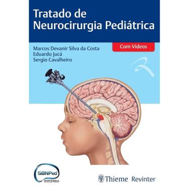 Imagem de Tratado de Neurocirurgia Pediátrica