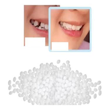 Imagem de Massa Restauração Dente Provisório 150 Bolinhas Massa - Congratulation