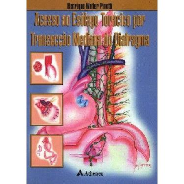 Imagem de Acesso ao Esofago Toracico por Transeccao - Mediana do Diafragma - ATH