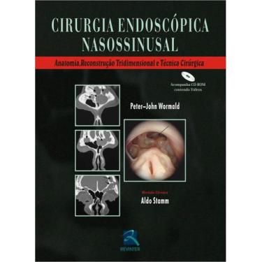 Imagem de Livro - Cirurgia Endoscopica Nasossinusal