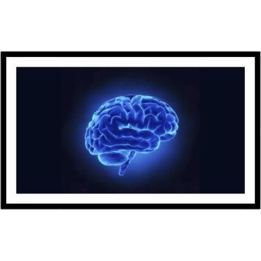 Imagem de Quadro Decorativo Medicina Médicos Cérebro Neurologia Psiquiatria Cons