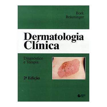 Imagem de Livro - Dermatologia Clínica
