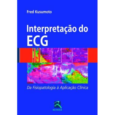 Imagem de Livro - Interpretação do ECG