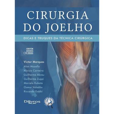Imagem de Cirurgia Do Joelho Dicas E Truques Da Tecnica Cirurgica