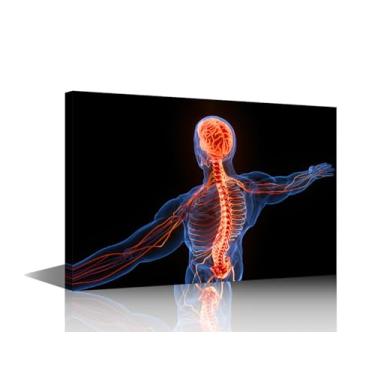 Imagem de TUMOVO Arte de parede em tela de raio-X da coluna humana, imagens de cérebro para sala de estar, anatomia humana, ortopédica, pintura médica, arte de parede para escritório emoldurada pronta para