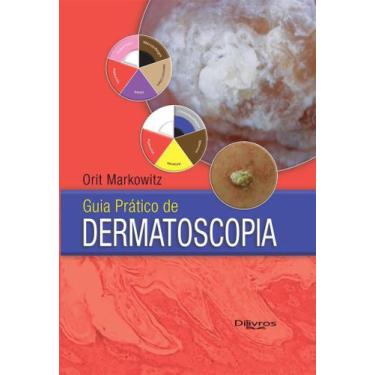 Imagem de Guia Pratico De Dermatoscopia - Dilivros