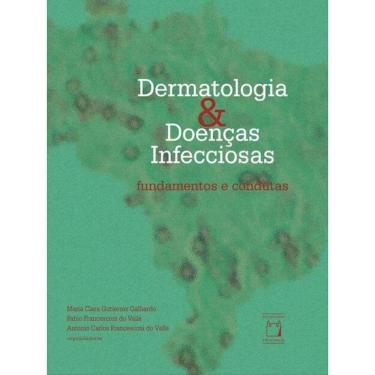 Imagem de Dermatologia E Doenças Infecciosas