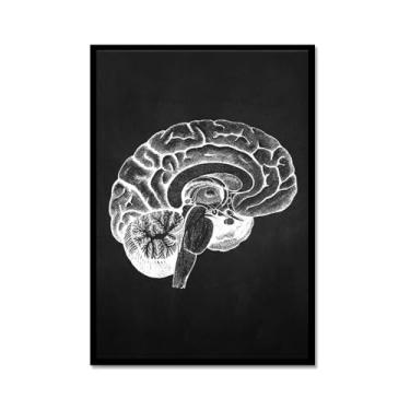 Imagem de Fundo preto anatomia humana arte médica impressões imagens esqueleto músculo pôster vintage educação pintura arte decoração de parede (SKU10,30.5x40.6 cm = (30x40cm), moldura de metal preto)