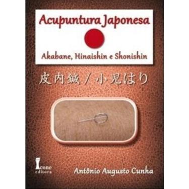 Imagem de Livro - Acupuntura Japonesa: Akabane, Hinaishin e Shonishin - Cunha