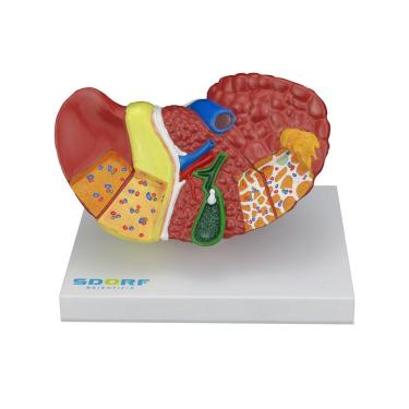Imagem de Modelo Patológico do Fígado e Vesícula Biliar