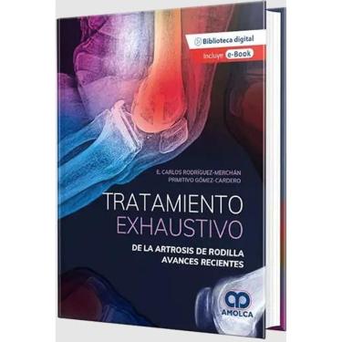 Imagem de Tratamiento Exhaustivo De La Artrosis De Rodilla