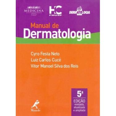 Imagem de Manual De Dermatologia - (Manole)