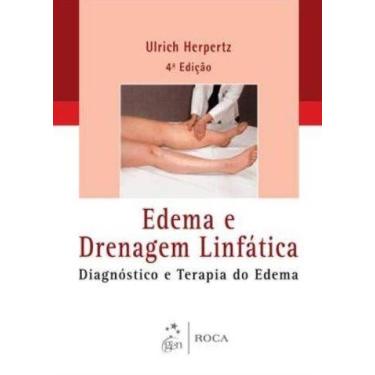 Imagem de Livro - Edema e Drenagem Linfática - Diagnóstico e Terapia do Edema