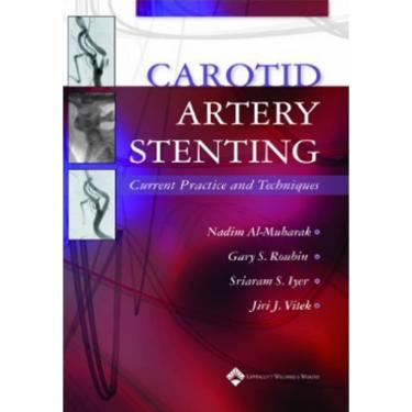 Imagem de Carotid Artery Stenting: Current Practice And Techniques