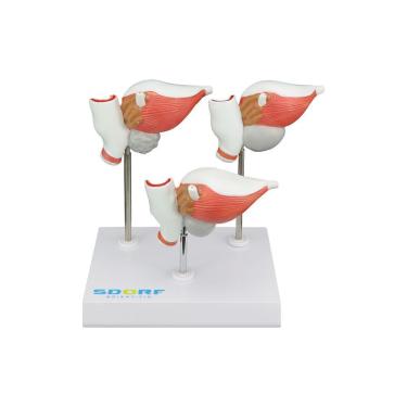 Imagem de Modelo Patológico da Próstata em 3 Fases SD-5211