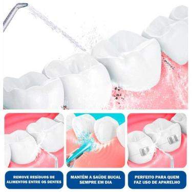 Imagem de Limpador Bucal Elétrico Bivolt 7 Bicos Diferentes Dente E - Relet