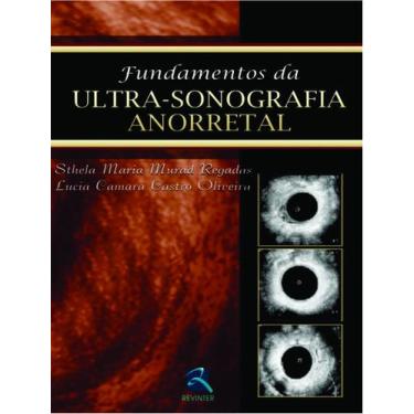 Imagem de Livro - Fundamentos da Ultrassonografia Anorretal