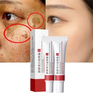 Imagem de fupah Peças de Creme Clareador para Sardas, Creme de Tratamento para Remoção de Cicatrizes de Acne, Creme para Remoção de Pigmentação para Rosto, Hidratante Remove Melasma Facial, Manchas Escuras, Rugas e Manchas (Creme Clareador para Sardas)