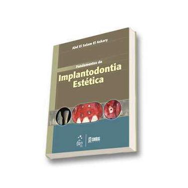  Nocoes de Implantodontia Cirurgica: 9788536702582: Ricardo de  Souza Magini e Outros: Books