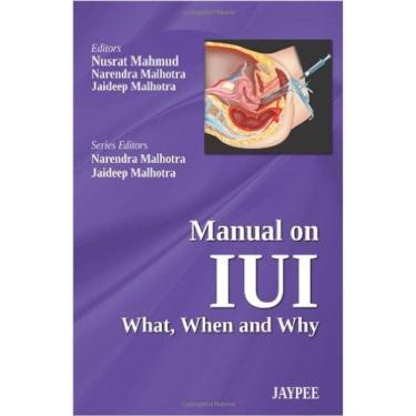 Imagem de Manual On Iui: What, When And Why