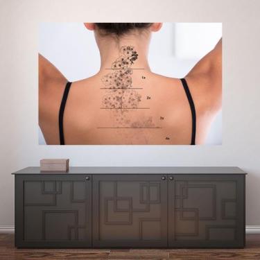 Imagem de Painel Adesivo de Parede - Remoção de Tatuagem - 1198pnm - Allodi