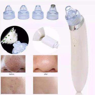 Imagem de Tira Cravos Espinhas Elétrico Limpeza Facial A Vácuo 4 Bicos - USB - M