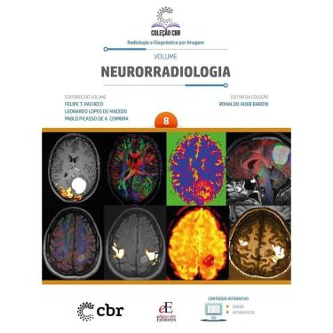 Imagem de Coleção CBR Volume 8 NEURORRADIOLOGIA