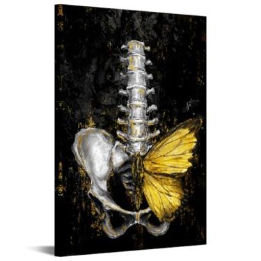 Imagem de iKNOW FOTO Arte de parede anatômica da coluna com borboleta dourada 40,6 x 61 cm impressão em tela de esqueleto médico para escritório médico, enfermeira, fisioterapia, clínica, decoração pronta para