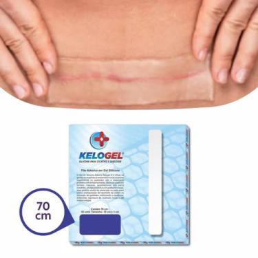 Imagem de Fita Para Cicatriz Queloide Gel Silicone Kelogel 70cm X 3cm