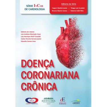 Imagem de Livro - Doença Coronária Crônica