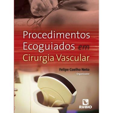 Imagem de Procedimentos Ecoguiados Em Cirurgia Vascular
