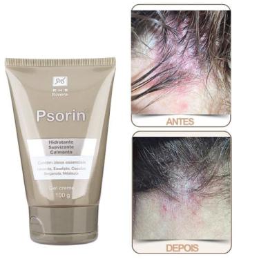 Imagem de Creme para Psoríase  Psorin 100gr - RHR