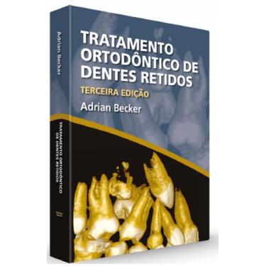 Imagem de Tratamento Ortodôntico De Dentes Retidos - Santos Publicações