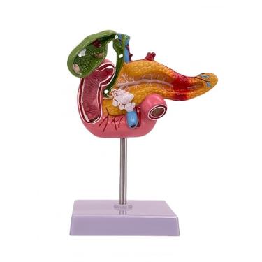 Imagem de DRXRD Modelo de pâncreas hepatobiliar com cálculos biliares - Kit de treinamento de cirurgia da vesícula biliar - Auxílio de ensino de medicina para gastroenterologia e biologia do sistema digestivo