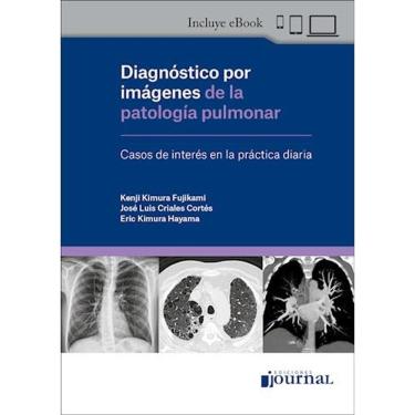 Imagem de Diagnostico Por Imagenes De La Patologia Pulmonar
