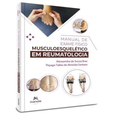 Imagem de Manual De Exame Fisico Musculoesqueletico Em Reumatologia