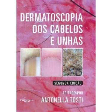 Imagem de Livro Dermatoscopia Dos Cabelos E Unhas 2ª Edição - Di Livros -