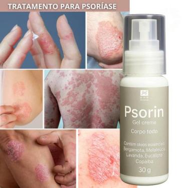 Imagem de Auxílio no Cuidado da Pele com Psoríase - Psorin 30g - RHR