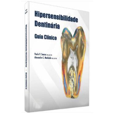 Imagem de Hipersensibilidade Dentinária Guia Clínico