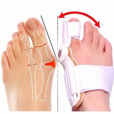 Imagem de Par de Protetor Corretor Para Joanete Hallux Valgus Articulado - Alívi