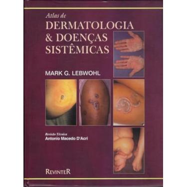 Imagem de Atlas Dermatologia E Doencas Sistemicas -01ed/2000