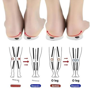 Imagem de Palmilhas Ortopédicas Unissex De Gel De Silicone Para Correção De Pern