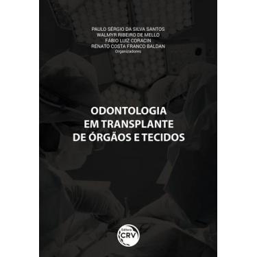 Imagem de Livro - Odontologia Em Transplante De Órgãos E Tecidos