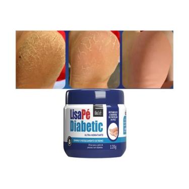 Imagem de Produto Hidratante Pés Diabéticos Ressecados Com Rachaduras - Bio Soft