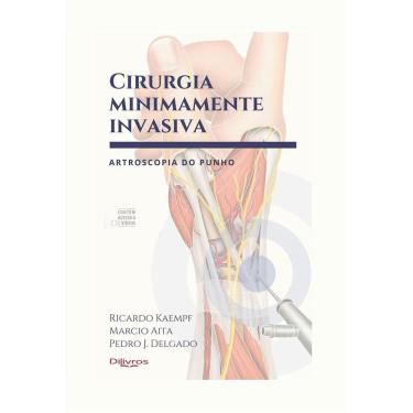 Imagem de Cirurgia Minimamente Invasiva Artroscopia Do Punho