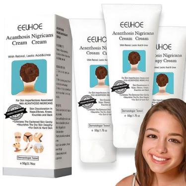 Imagem de Creme removedor de manchas Yuehao para corpo, axilas, pescoço, joelhos