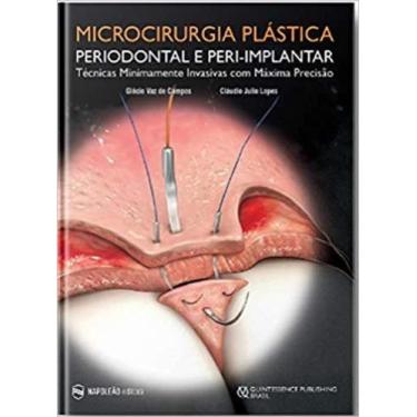Imagem de Microcirurgia plastica periodontal e peri-implantar tecnicas minimamen