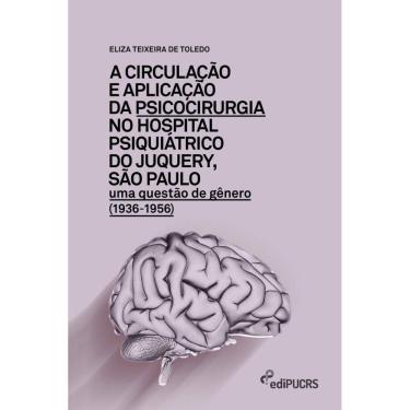 Imagem de A circulação e aplicação da psicocirurgia no hospital psiquiátrico do Junquery, São Paulo: uma questão de gênero (1936-1956)