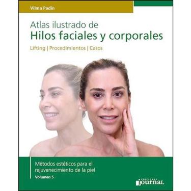 Imagem de Atlas Ilustrado De Hilos Faciales Y Corporales