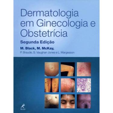 Imagem de Livro - Dermatologia Em Ginecologia E Obstetrícia